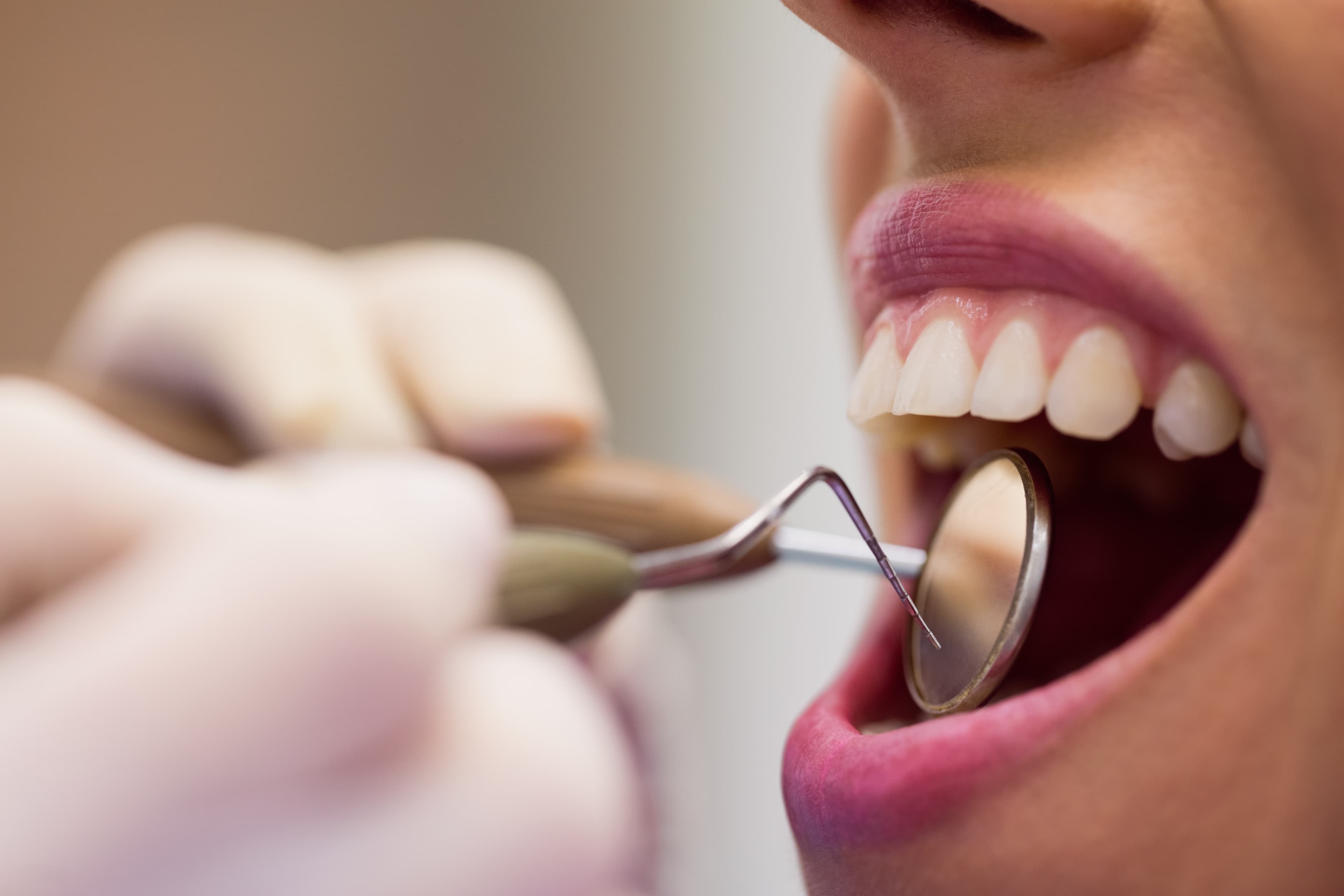 Periodoncia imagen
